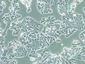 iPS cells